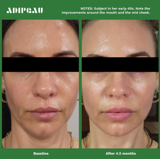 Adipeau - Volume Cream