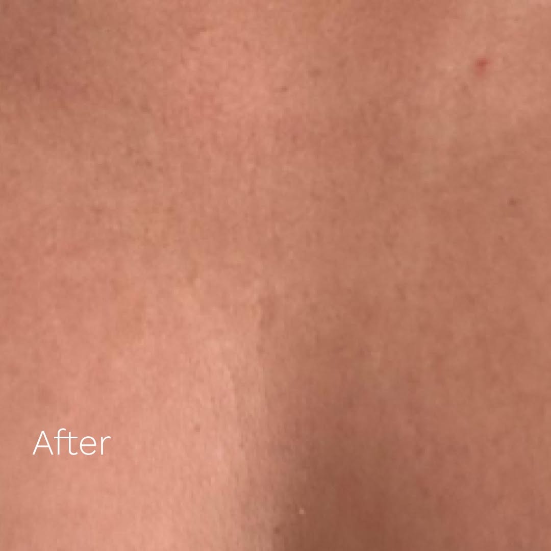 Adipeau - Strong Body Gel