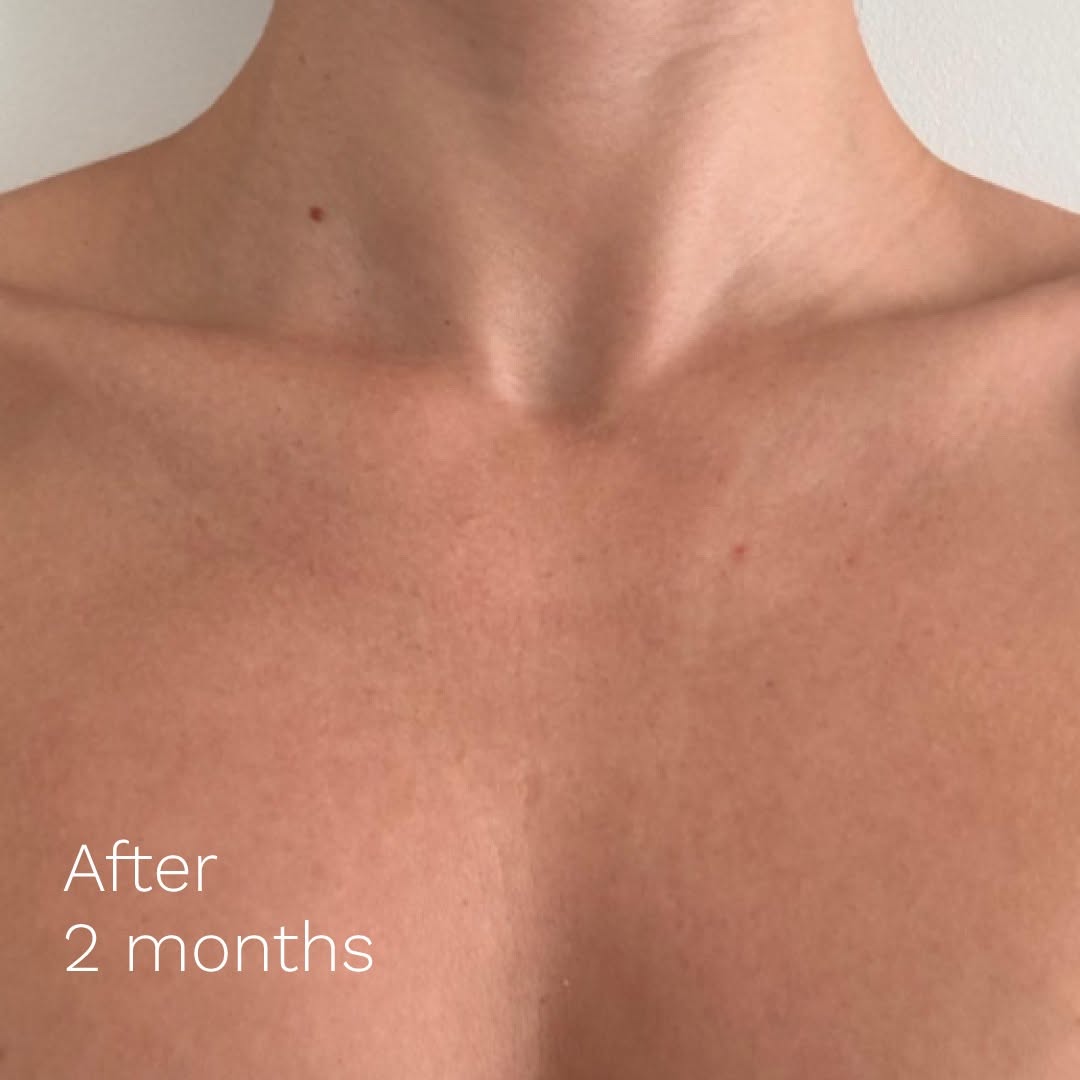 Adipeau - Strong Body Gel