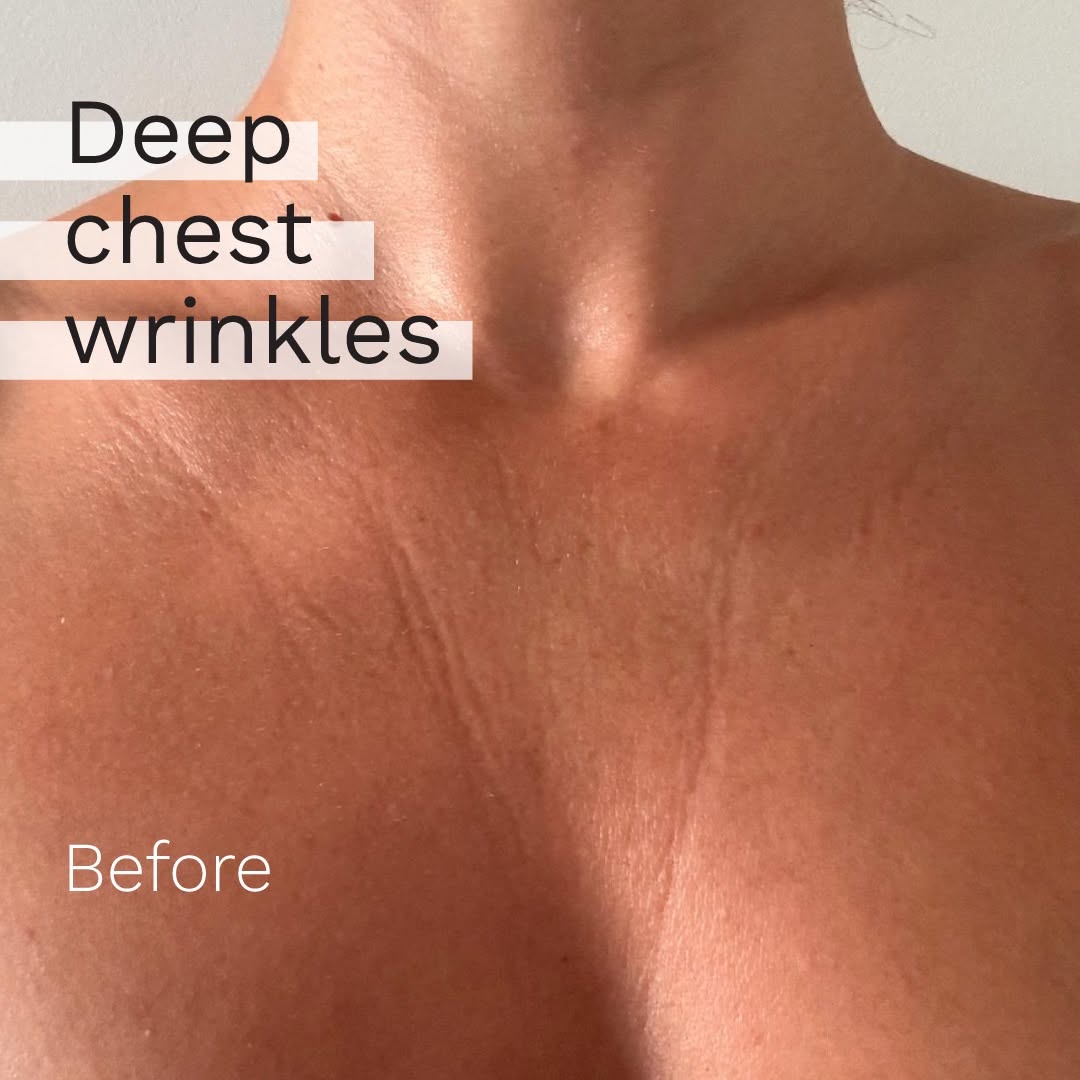 Adipeau - Strong Body Gel