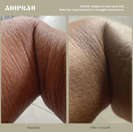 Adipeau - Strong Body Gel
