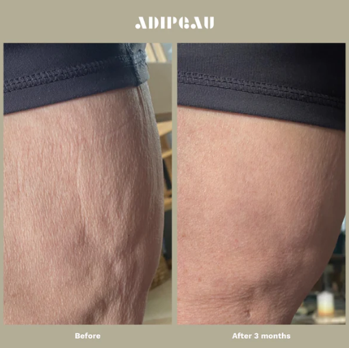 Adipeau - Strong Body Gel