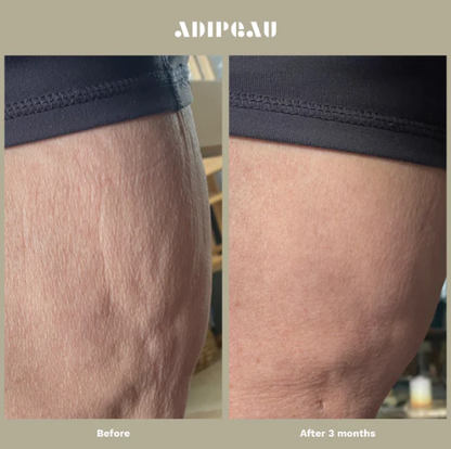 Adipeau - Strong Body Gel