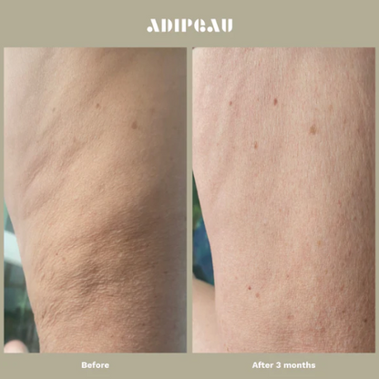 Adipeau - Strong Body Gel
