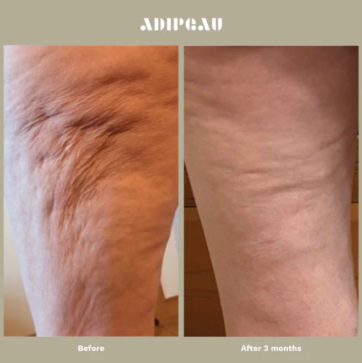 Adipeau - Strong Body Gel