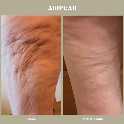 Adipeau - Strong Body Gel