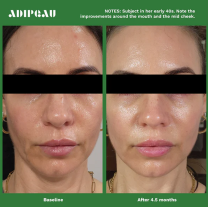 Adipeau - Volume Cream