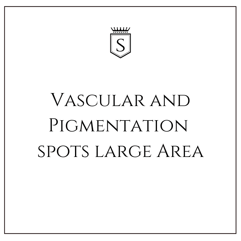 Vascular and Pigmentation Spots (Large Area)